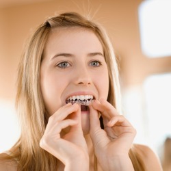 Girl Whitening Her Teeth
