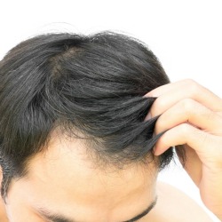 A man touching his hair.
