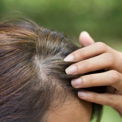 Young woman shows her gray hair roots.