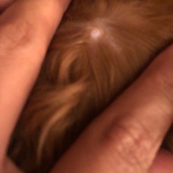 Puppy Has Weird Bumps on Chest - fingers parting hair to see bump